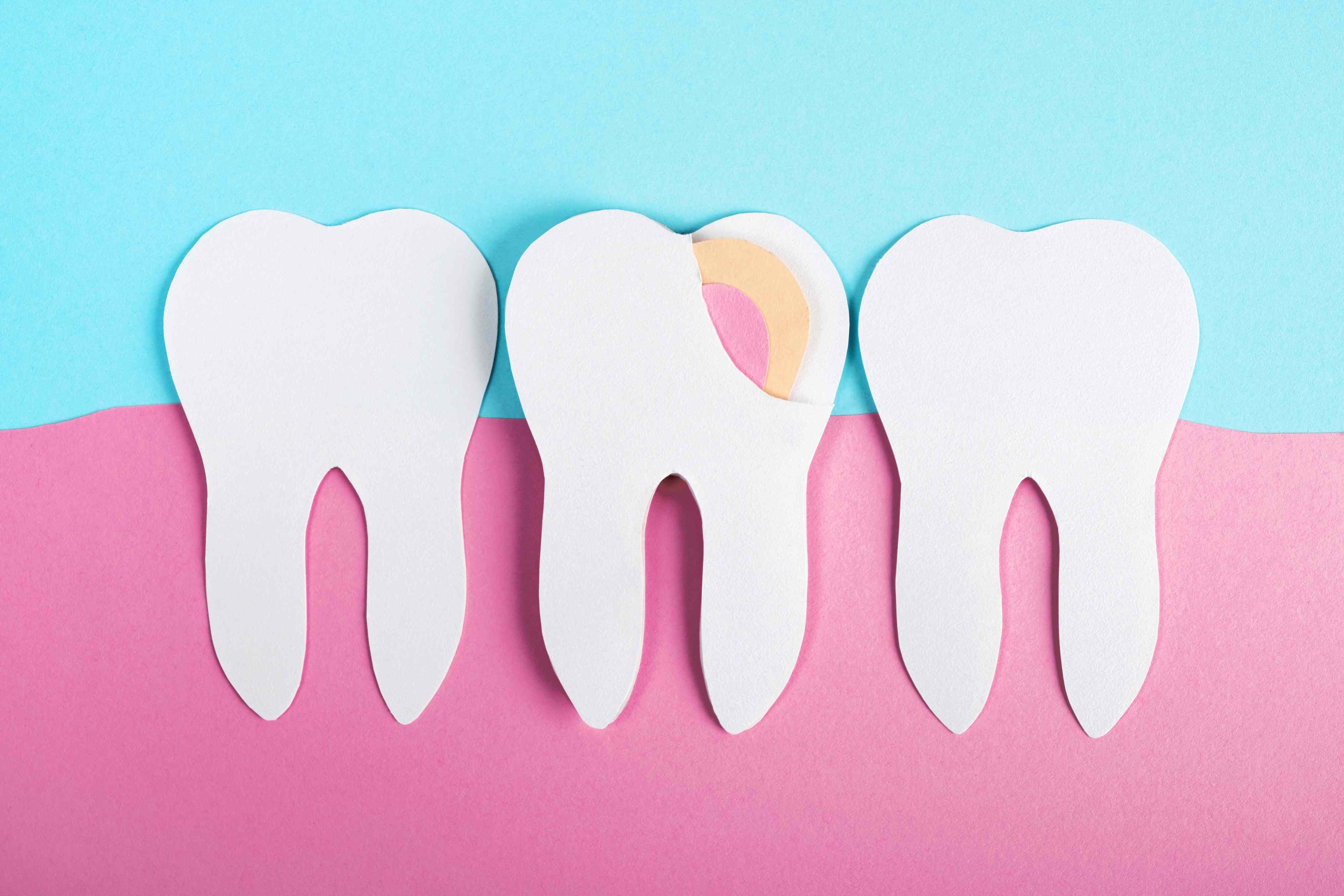 Too Much of This Food May Harm Your Oral Health, New Study Says—and It ...