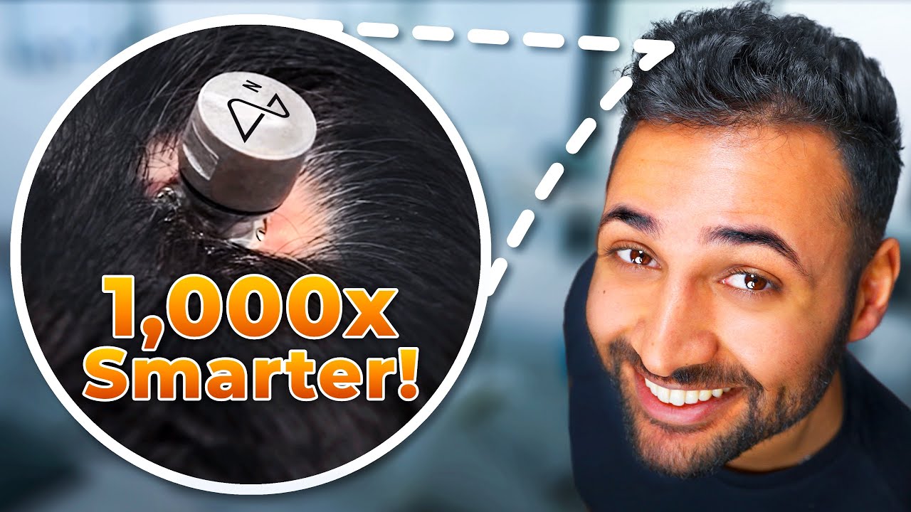 Inside the Brain Chip Revolution What You’re Not Being Told