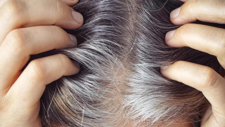 Grey Hair in Your 20s & 30s: The Role of Nutrition & Functional Medicine