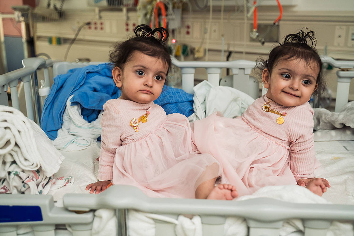 15MonthOld Conjoined Twins Separated in Rare Surgery. See How They’re
