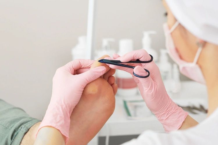 9 Cara Efektif Menghilangkan Kapalan, Kaki Lebih Halus