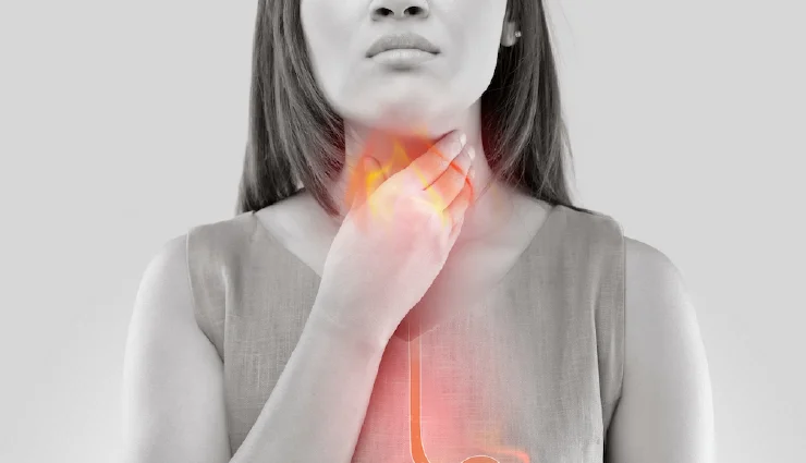 7-foods-that-help-to-fight-acid-reflux