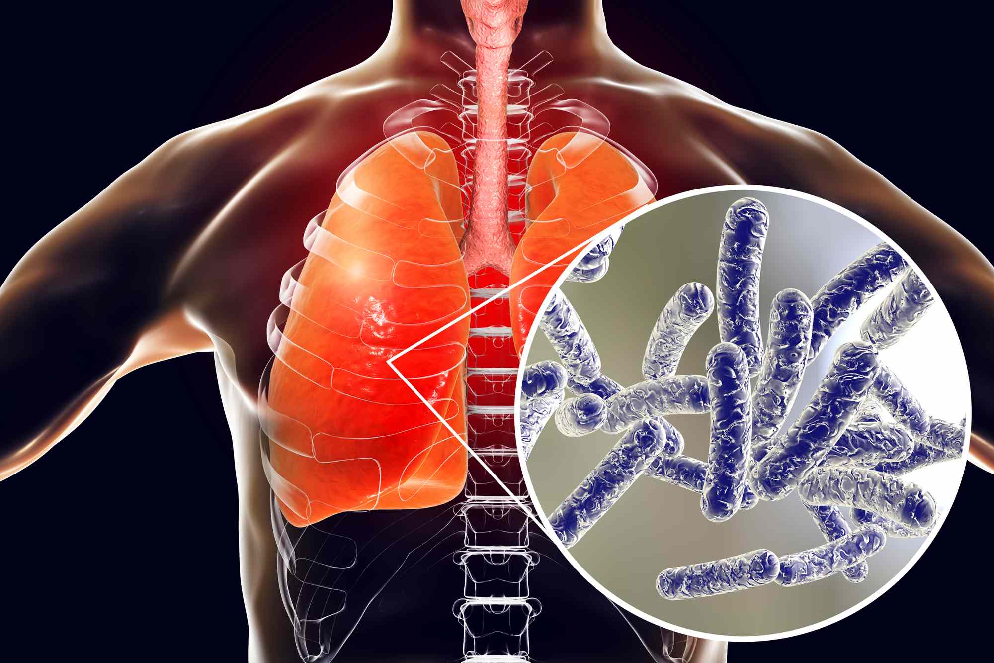 5 dead and 82 sickened amid Legionnaires’ disease outbreak in New York City’s Upper East Side