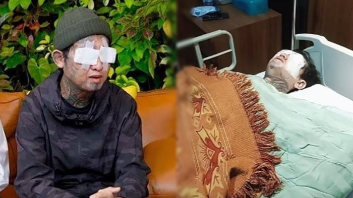 3 Hal Aneh Kematian Icang yang Tewas Kecelakaan, Denny Sumargo Siap Viral: Kita Bantu