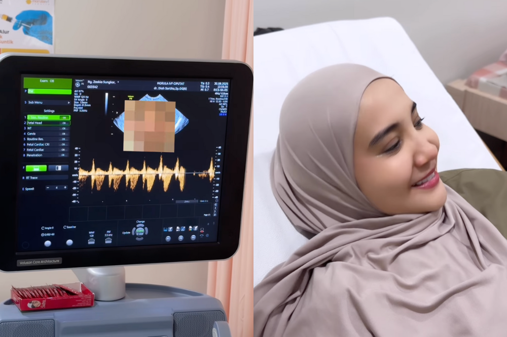 Doa Fenny Bauty untuk Kehamilan Zaskia Sungkar yang Kedua