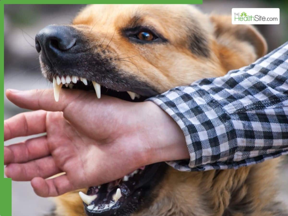 Rabies Alert: Why A Dog Bite Could Be Deadly? Here’s How You Can Stay ...