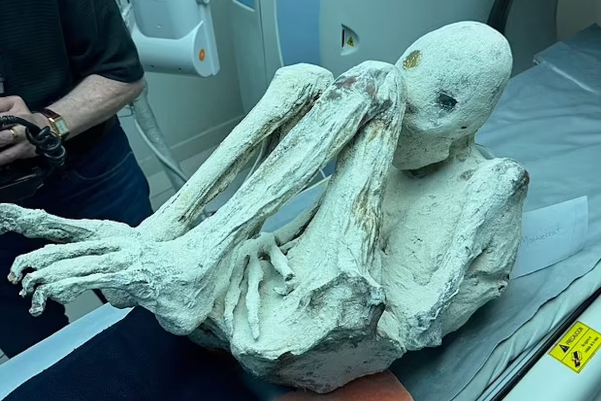 Maussan presented a new