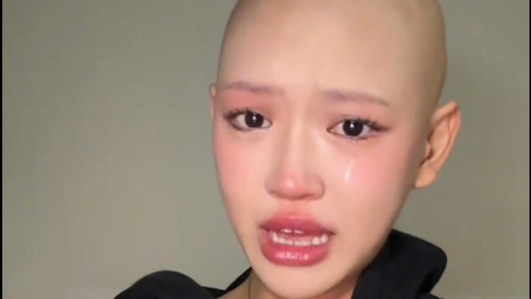 “I no longer found myself beautiful”: she shares her fight against the disease “I no longer found myself beautiful”: she shares her fight against the disease