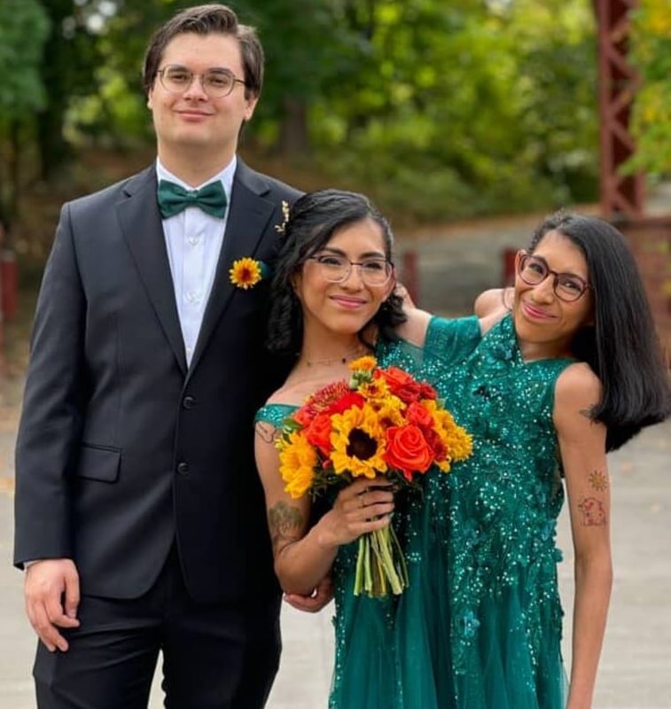 ‘My conjoined twin got married – it’s ok I can put headphones on’