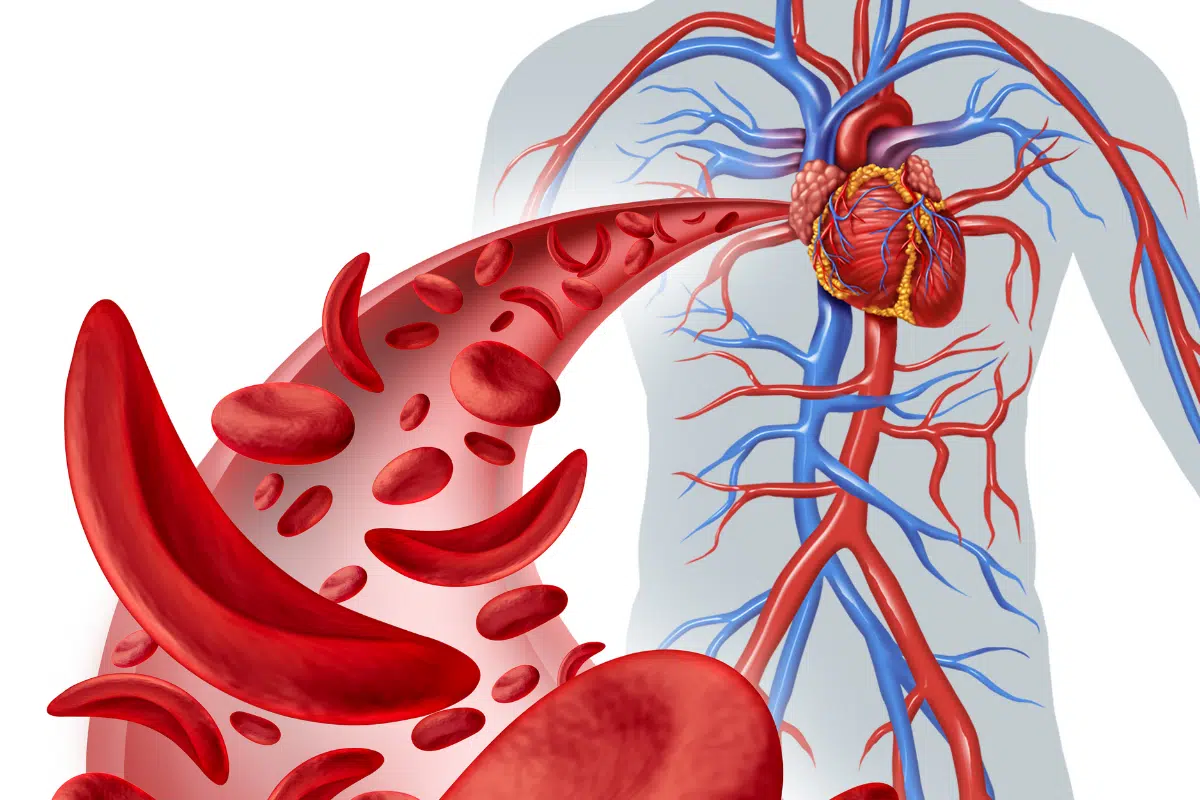 12 anti-inflammatory foods you should be eating more often