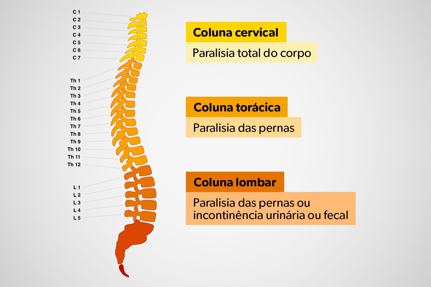 Fratura na coluna: sintomas, causas, como confirmar e tratamento