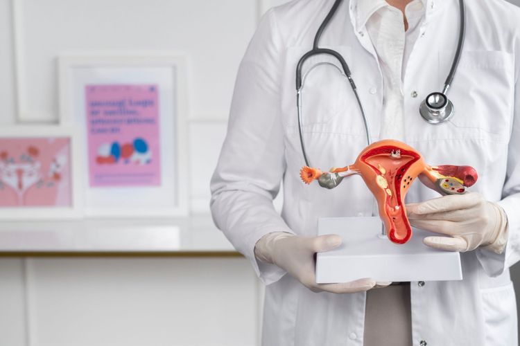 Wajib Baca! Ini Semua Tentang Sindrom Ovarium Polikistik (PCOS)