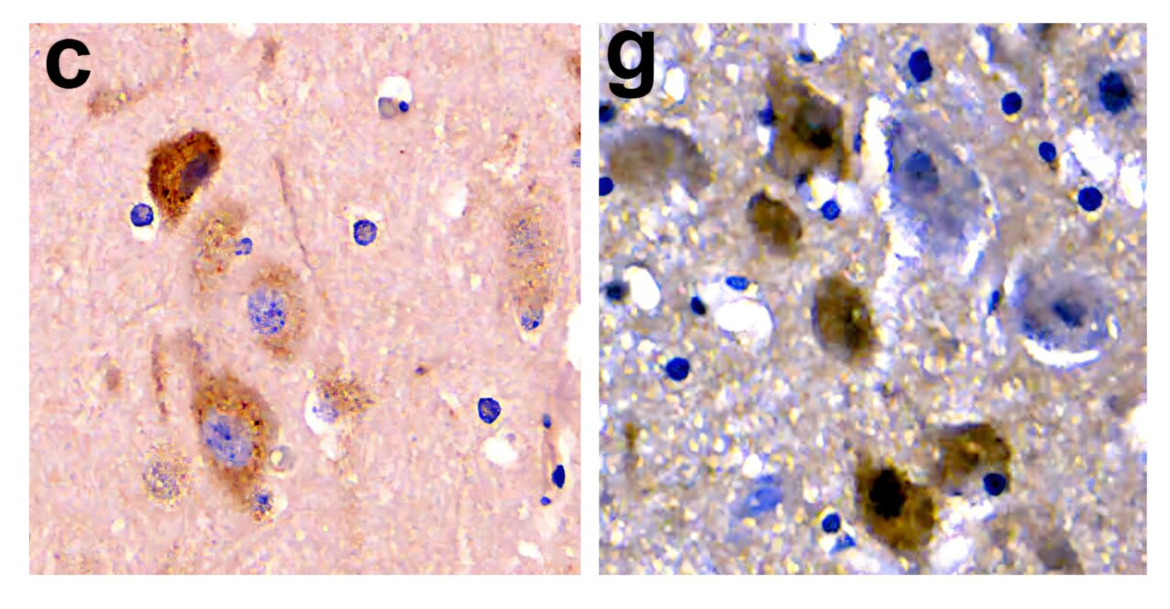 AA1NJWFq Apakah lumba-lumba yang terdampar menderita penyakit Alzheimer?