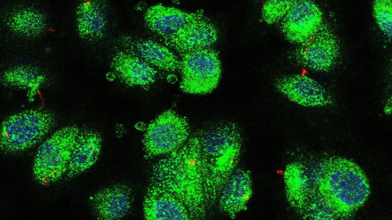 AA1NK0aU Pemetaan protein silia memberikan wawasan tentang penyakit anak-anak langka dan gangguan genetik