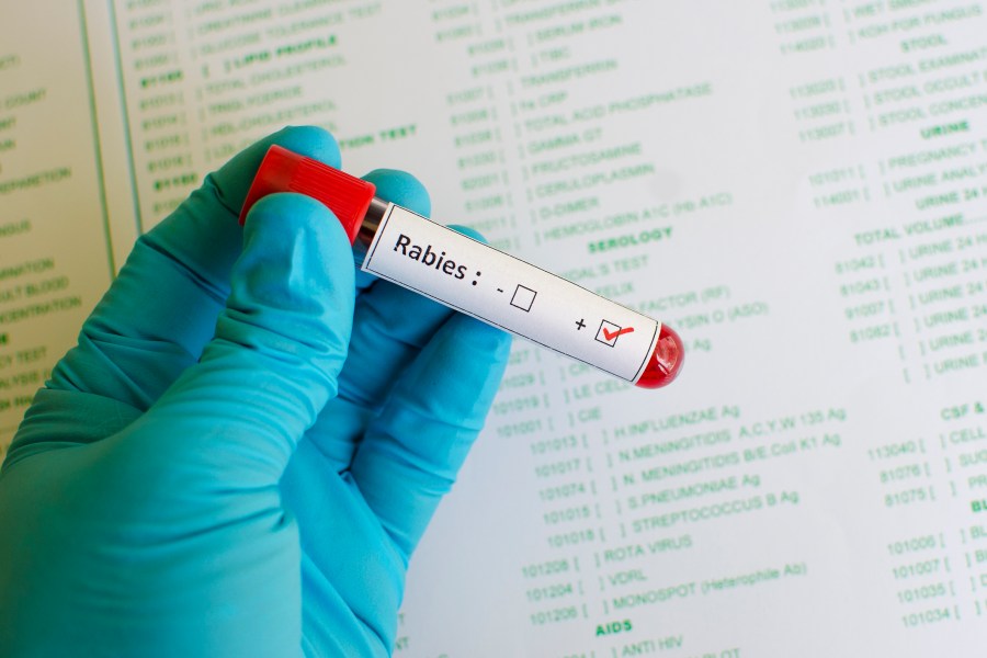 Fox found near Texas State campus tests positive for rabies