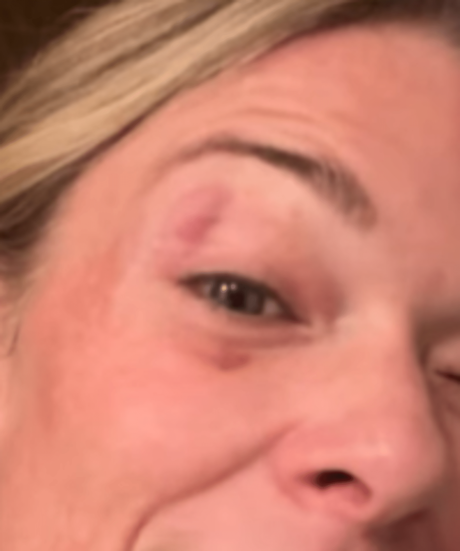 AA1NKGlh LeAnn Rimes Memperlihatkan Luka Mata yang Buruk — Disebabkan Botol Air