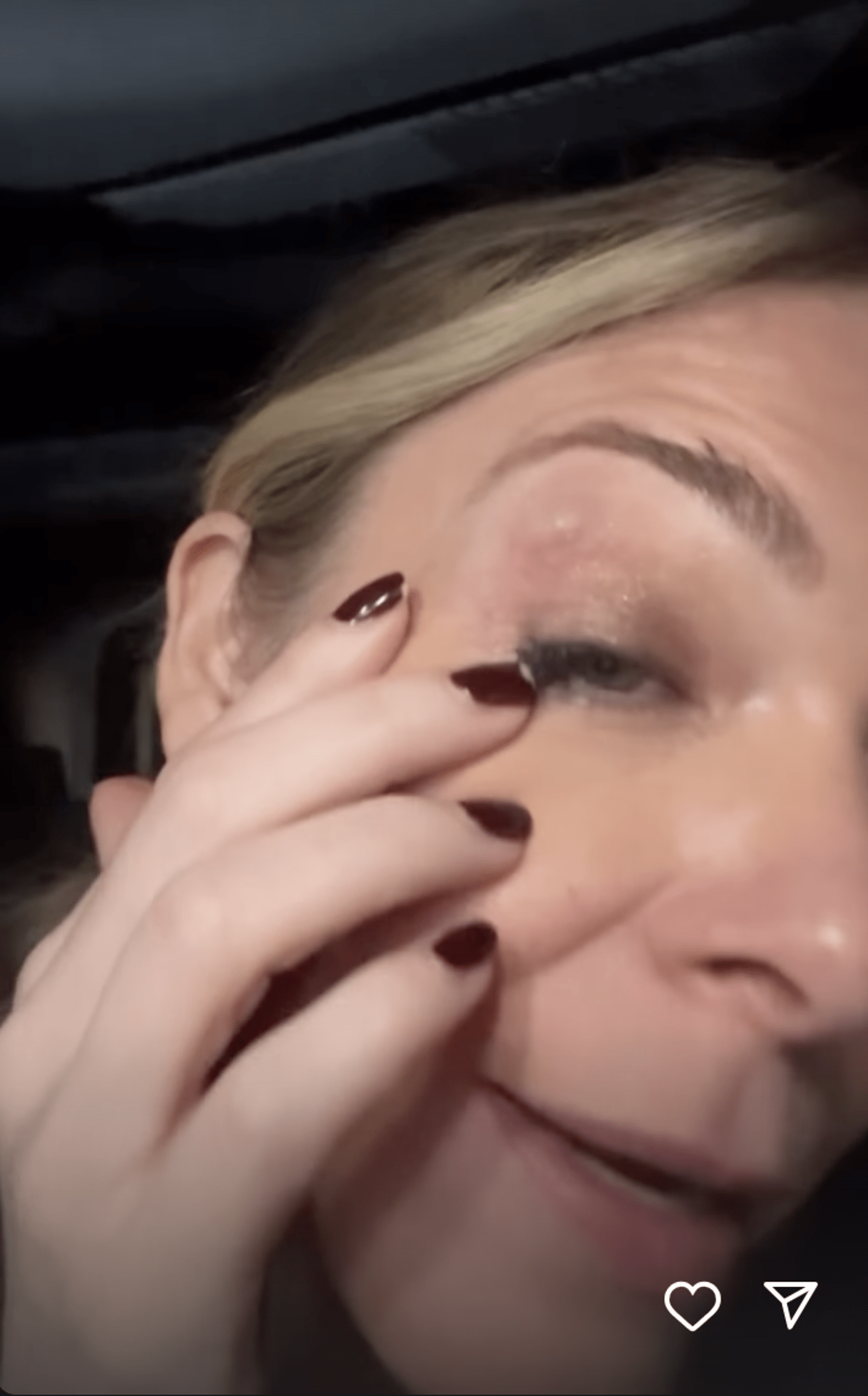 AA1NKSjC LeAnn Rimes Memperlihatkan Luka Mata yang Buruk — Disebabkan Botol Air