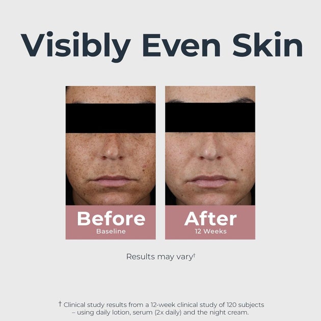 AA1NKvzv Para Pemeriksa Benar-Benar Melakukan 'Pengambilan Dua Kali' Setelah Menggunakan Serum Wajah Bercahaya Ini