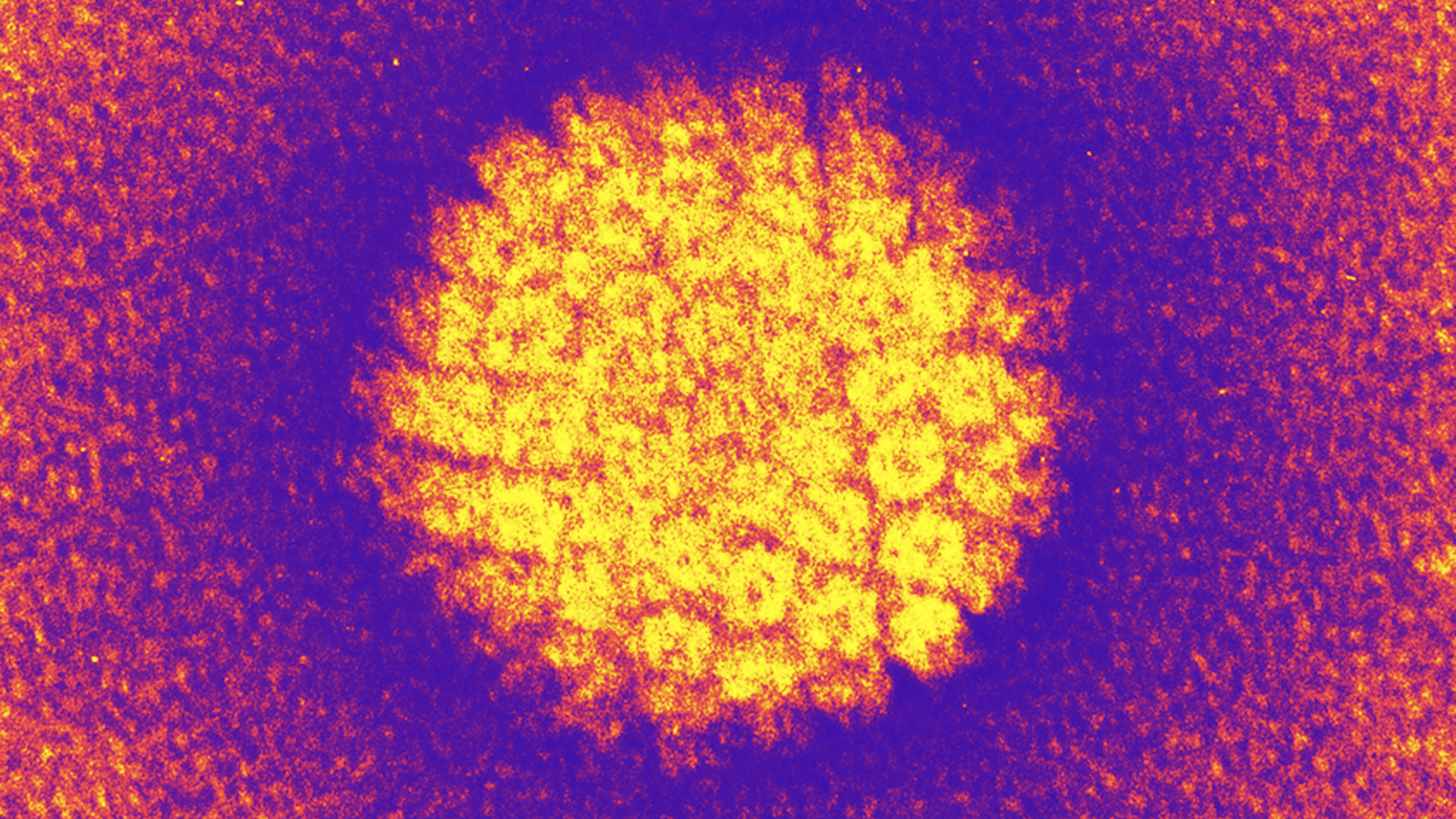 AA1NLjBn Kampanye vaksinasi HPV menurunkan tingkat kanker serviks baik pada orang yang divaksinasi maupun yang tidak divaksinasi