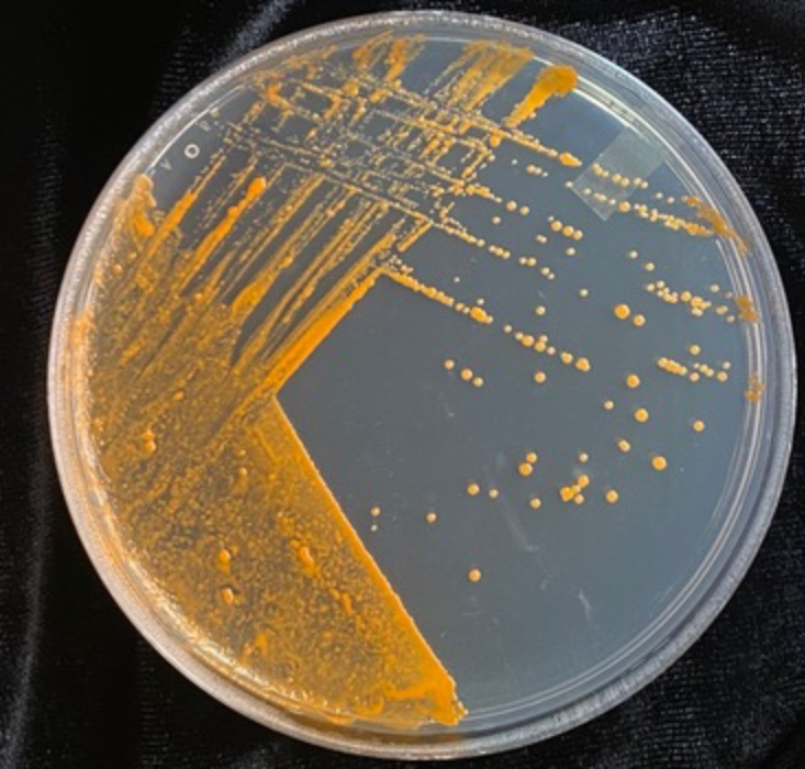 AA1NLmMO Kebakaran Hutan Merusak Anggur Favorit Anda. Bakteri Ini Mungkin Bisa Membantu