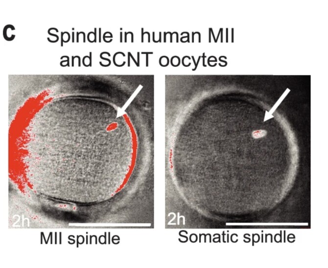 AA1NLu4u Ilmuwan Berhasil Menggunakan Sel Kulit untuk Membuat Sel Telur Manusia