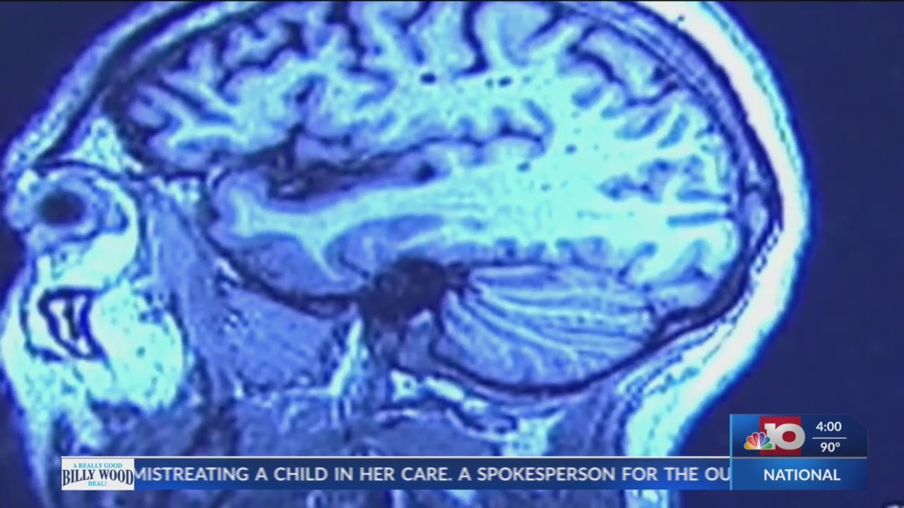 AA1NLzNh Cedera Otak: Umum, Tapi Sering Disalahpahami