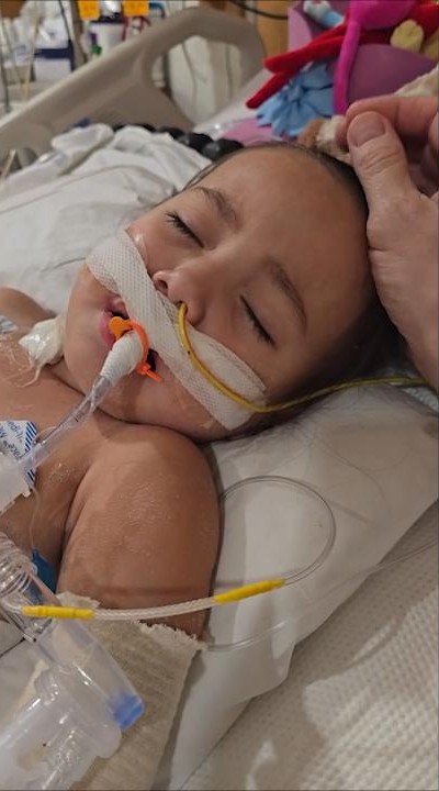 AA1NP2Vu ECMO Membantu Anak Berusia 3 Tahun Selamat dari Infeksi Langka