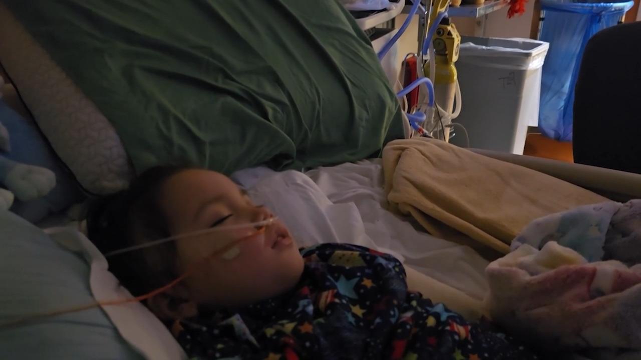 AA1NPcMR ECMO Membantu Anak Berusia 3 Tahun Selamat dari Infeksi Langka