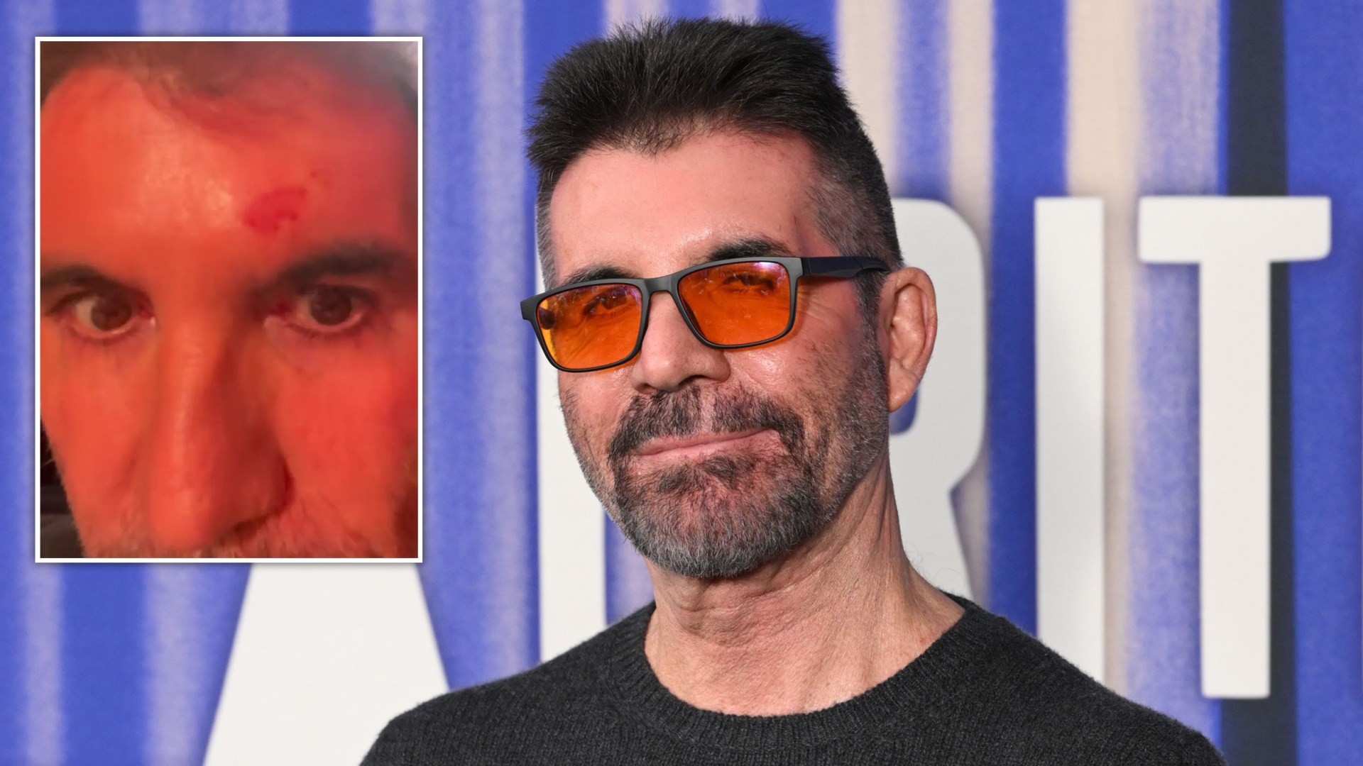 Simon Cowell skips BGT after shocking head injury