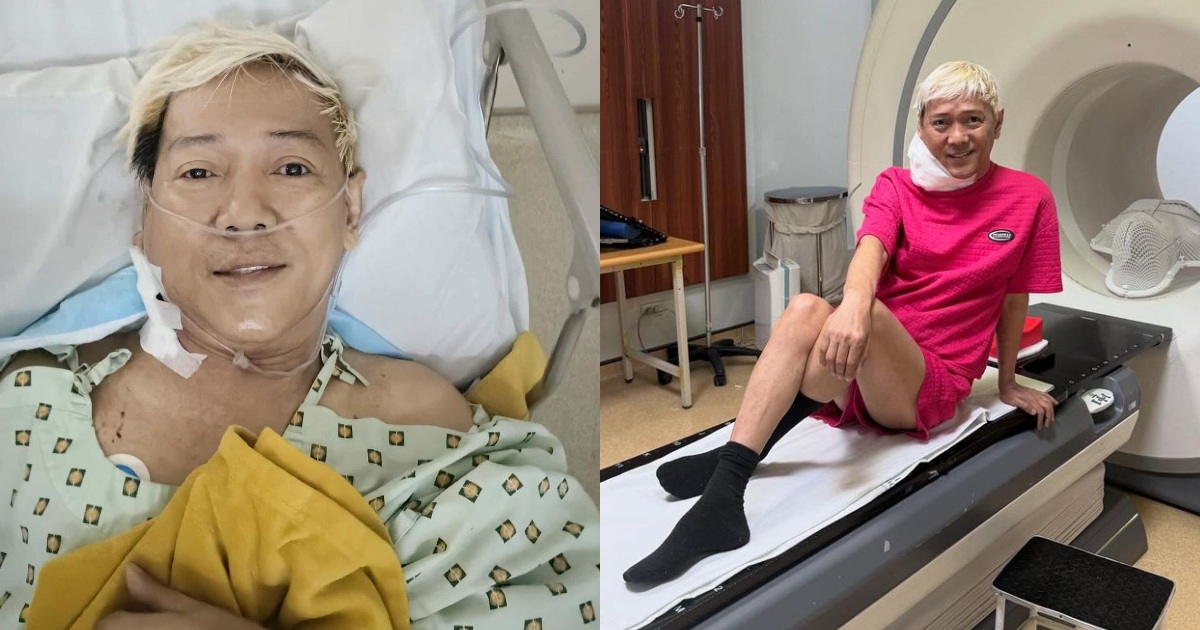 Ate Gay elated after lump in neck begins to shrink following cancer treatment