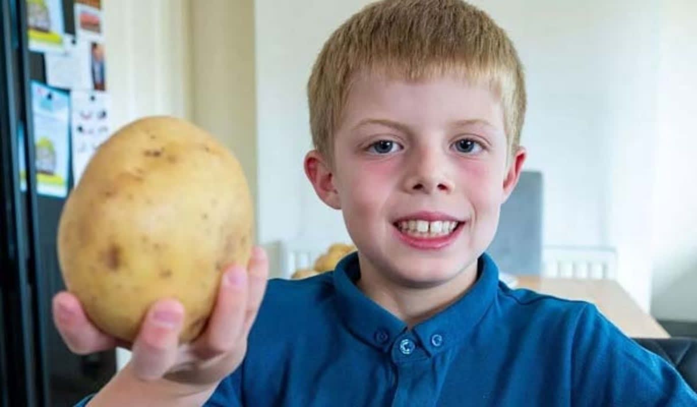 7年間「ポテト漬け」の8歳少年、2500個食べてようやく明かされた病気