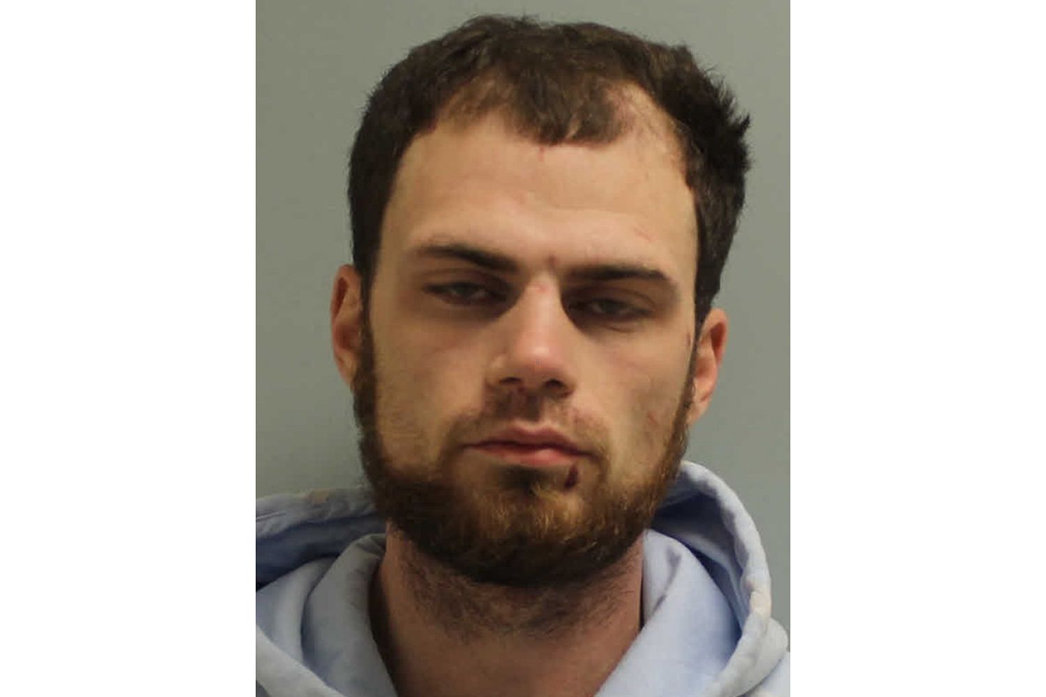 She Escaped As Alleged Kidnapper Slept A Day After She Was Driven To