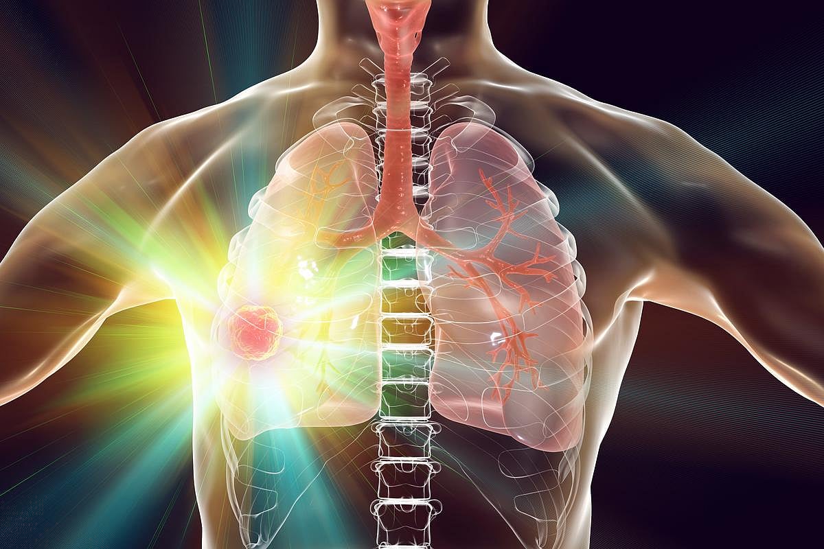 PFOS, PFHA, mono-iso-nonyl-phthalate can predict lung cancer mortality