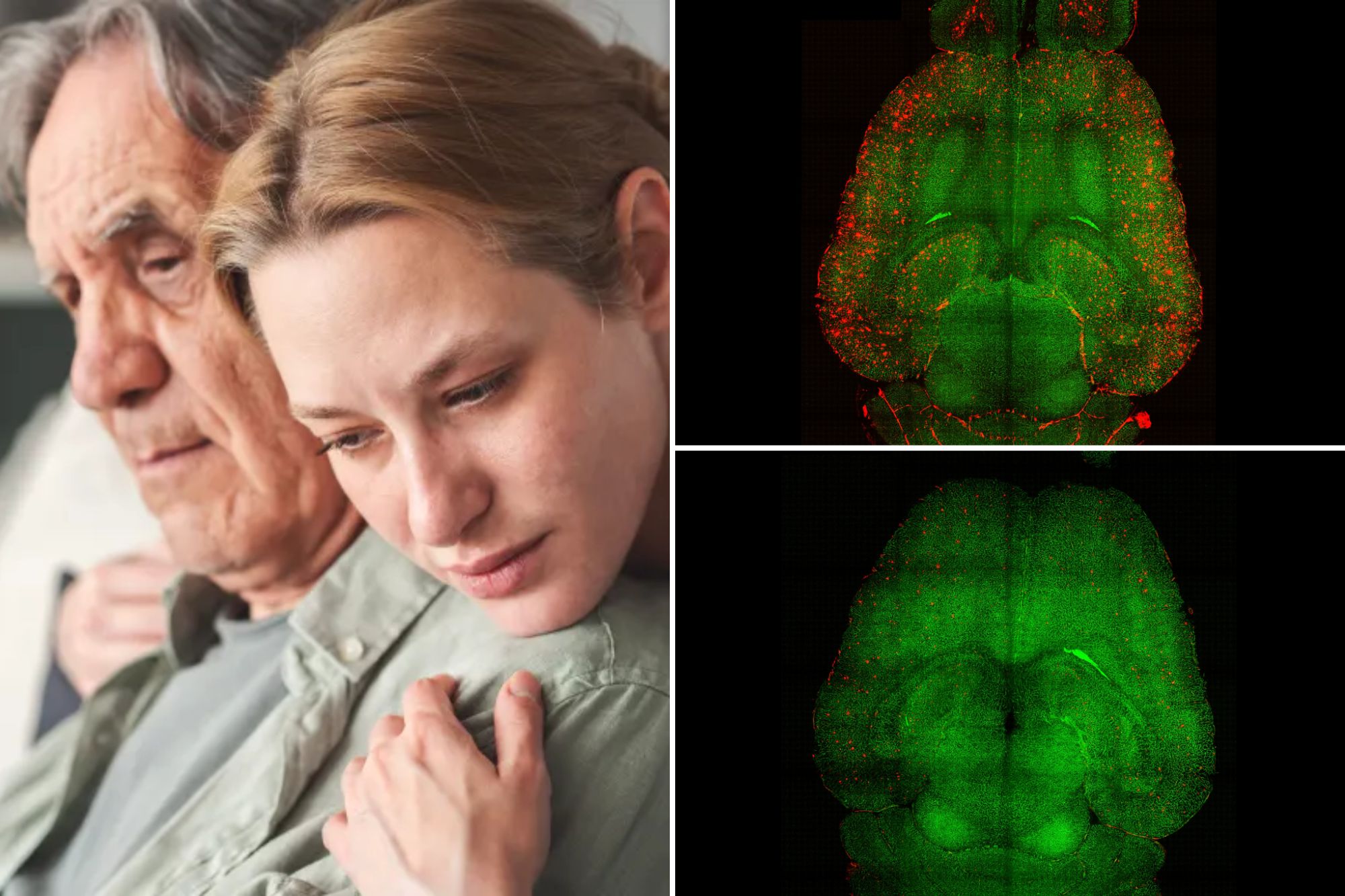 Alzheimer’s breakthrough? Scientists use nanotech to reverse disease in ...