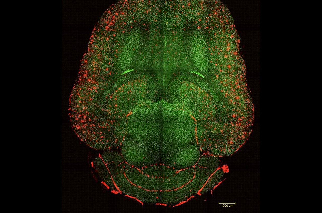 Scientists reverse Alzheimer's in mice using nanoparticles