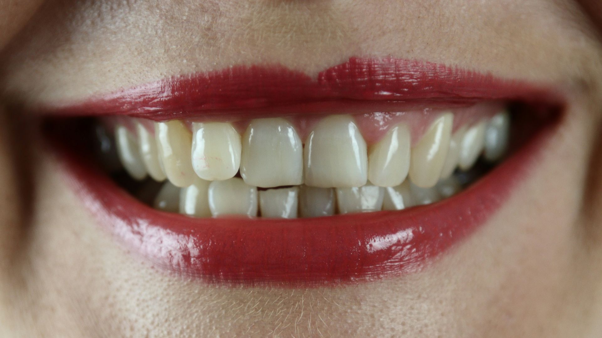 10 aliments qui jaunissent les dents et 10 qui les blanchissent — free download