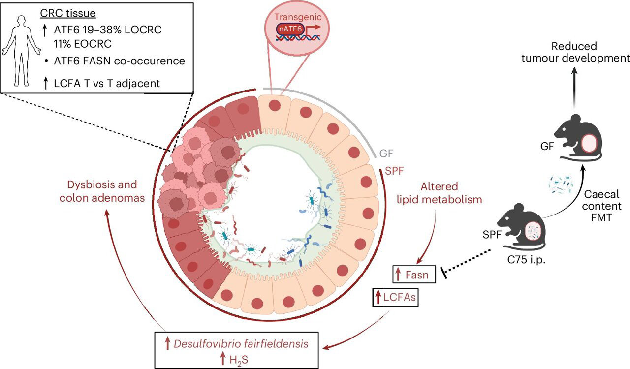 How chronic cellular stress shifts the gut microbiome toward a cancer How chronic cellular stress shifts the gut microbiome toward a cancer