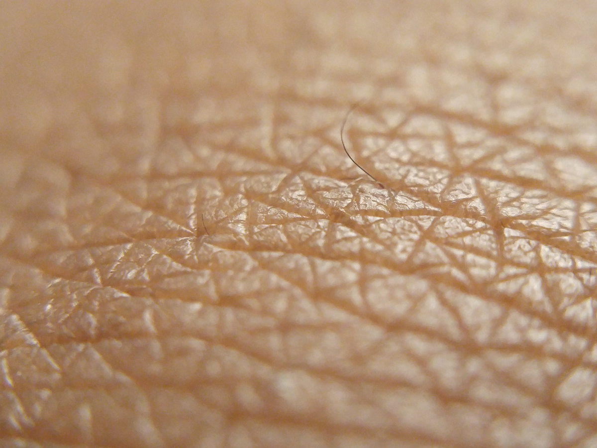 Changes in skin and hair