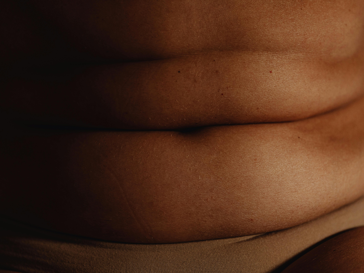 Unexplained weight gain around the abdomen