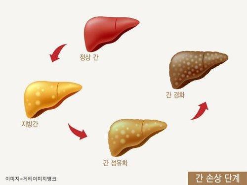 [건강포커스] 