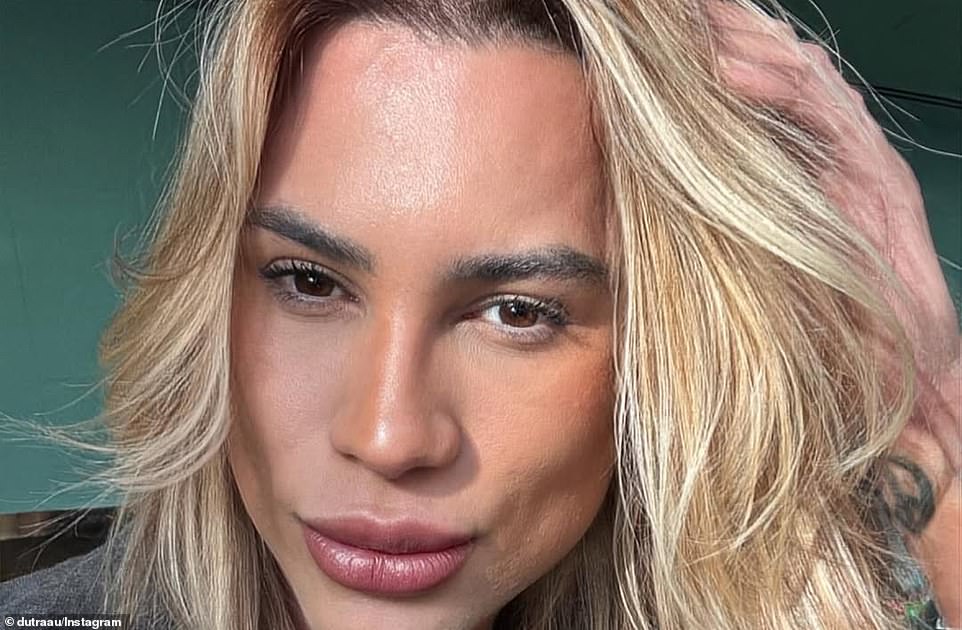 Brazilian fashion influencer dies at 31 after 'fox eyes' complications