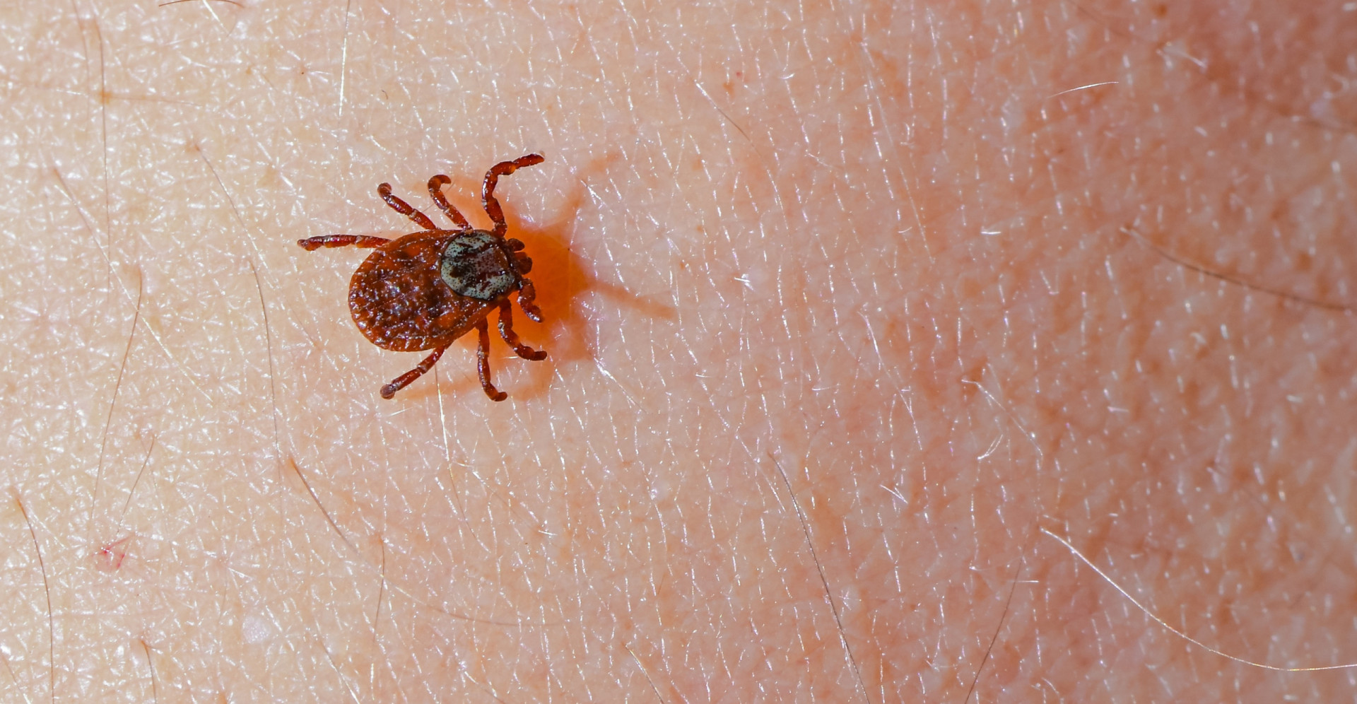 Bloodsucking Parasites What You Need To Know And How To Stay Safe