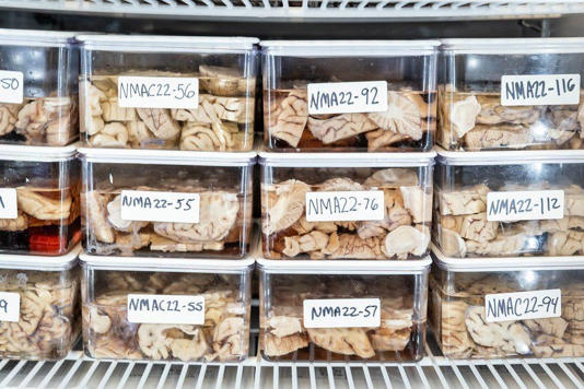 "Es bastante profundo cuando estás en el banco de cerebros y ves en última instancia la fuente de todas nuestras experiencias como humanos", dice Mather.