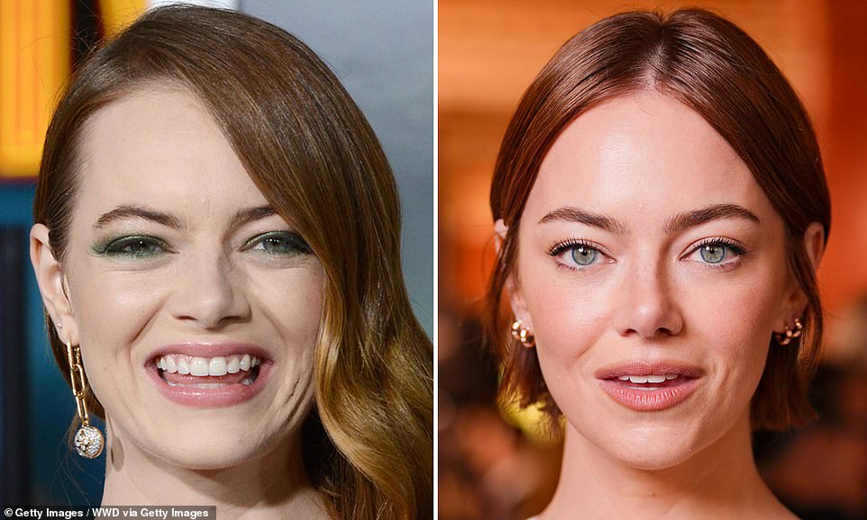 Plastic surgeons expose secrets behind Emma Stone's 'new face'
