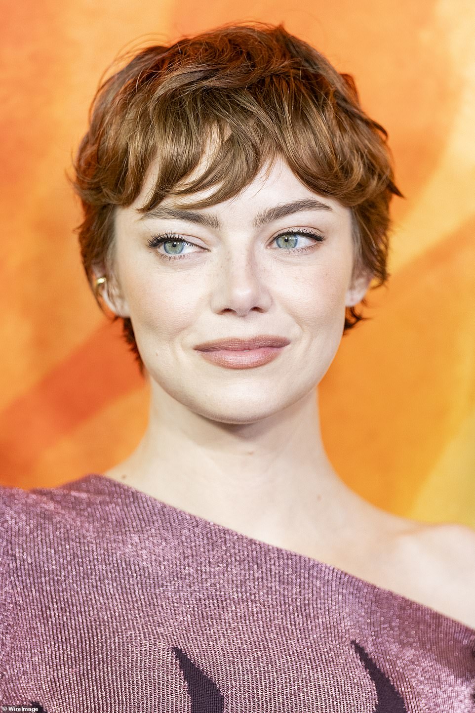 Plastic surgeons expose secrets behind Emma Stone's 'new face'