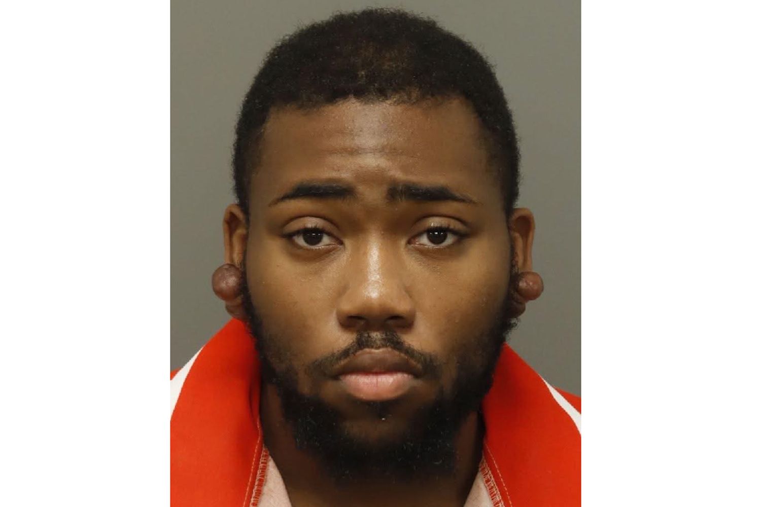 Patient Accused of Intentionally Spraying Blood into Eyes of 2 Hospital(02)