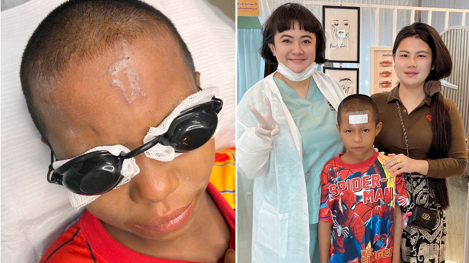 Bullies tattoo slur on boy's forehead, outrage ensues