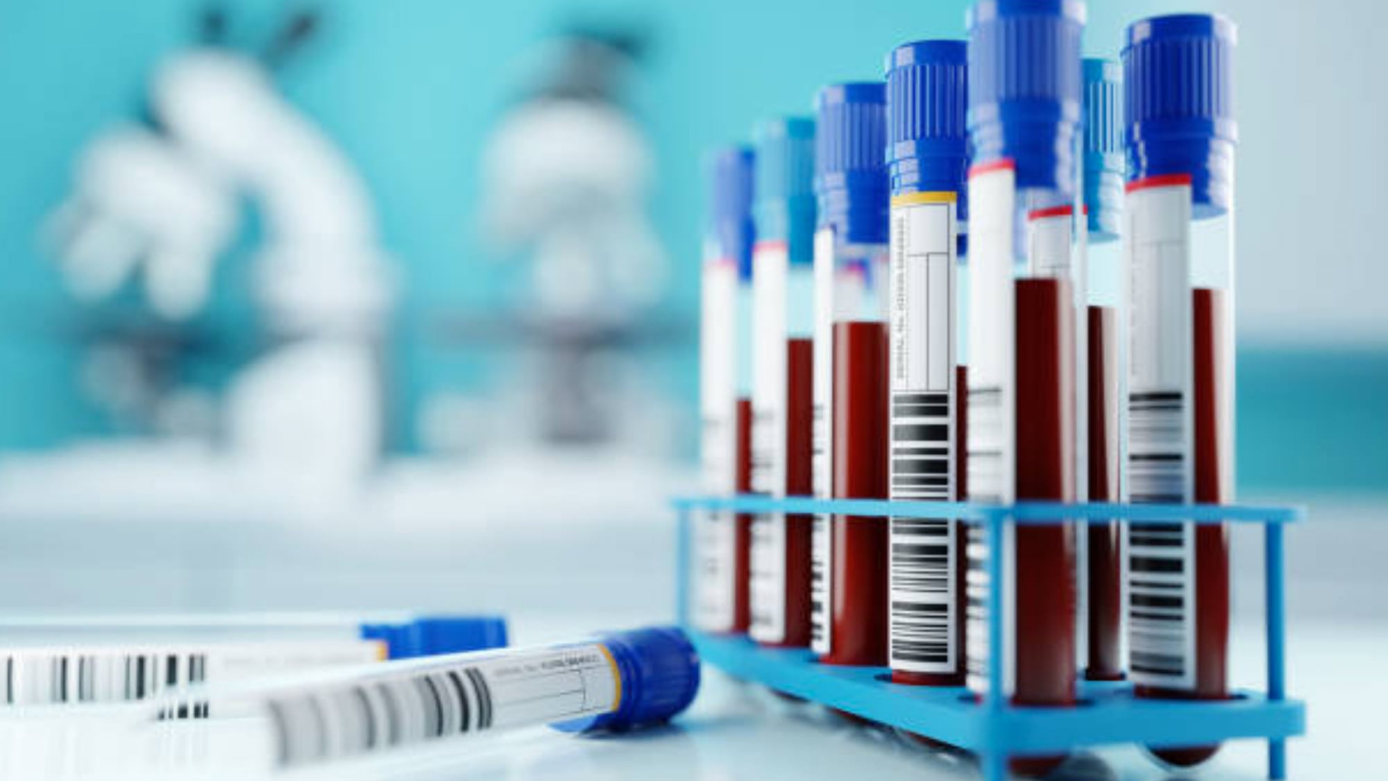Un Test Sanguin Détecte La Maladie D'Alzheimer Avec Une Précision De 90 %