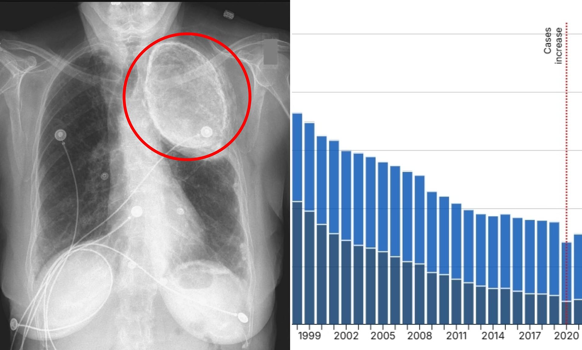 Scan reveals the shocking effects decadesold treatment has on woman