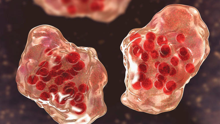 Person infected with measles visited Montgomery County urgent care ...